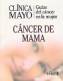 Cinica Mayo Cancer de Mama