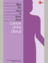 Uterine Cancer booklet cover