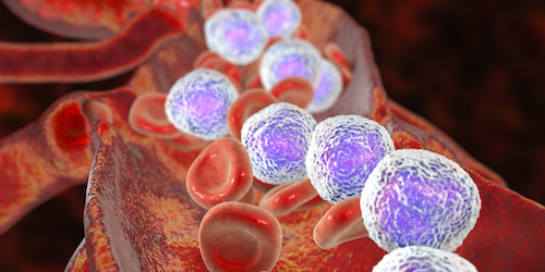 3D illustration showing abundant lymphoblasts in blood