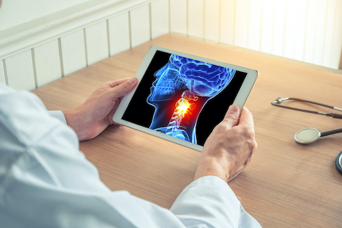 photo of physician sitting at a table looking at an illustration of neck cancer on a tablet