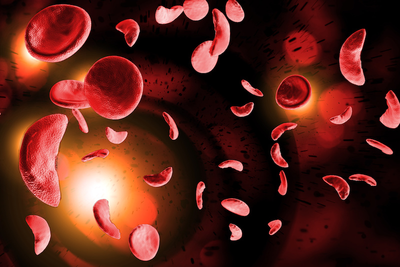 illustration of blood cells and sickle cells