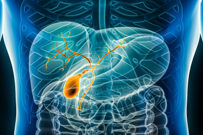 Model of an inflamed Biliary Tract system