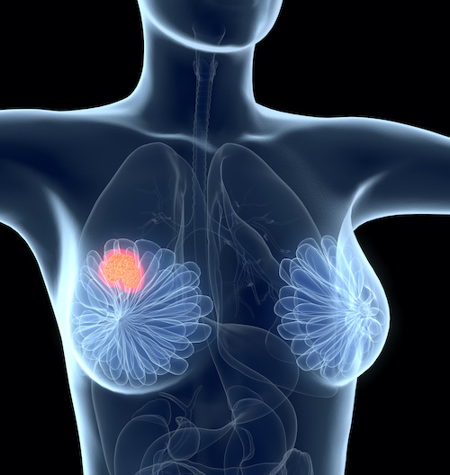computer illustration of breast tissue