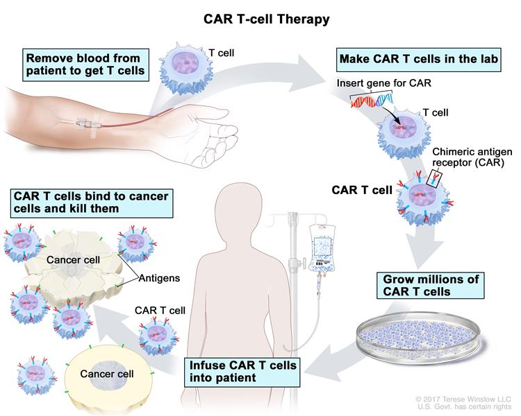 CAR T-cell therapy