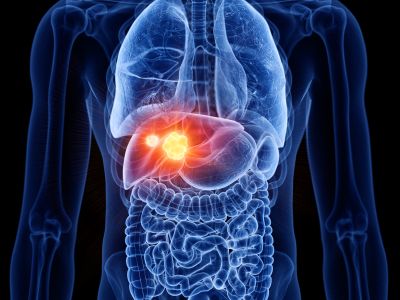 Blue graphic showing a glowing, inflamed liver