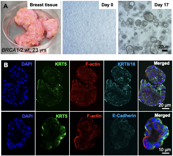 In culture 3D primary human organoids