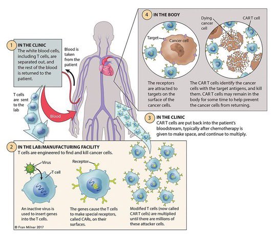 chart showing process of CAR T-cell treatment