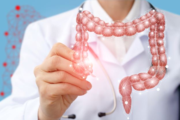 illustration of colon with irritated section indicating cancer