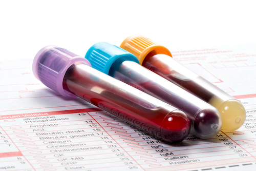 blood vials resting on sheet of paper