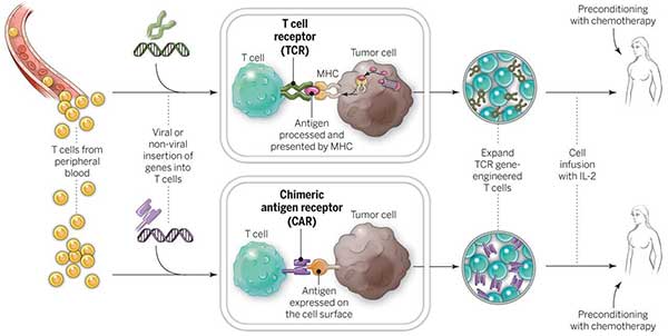 CAR T cells