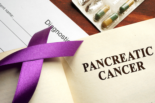 pancreas cancer image