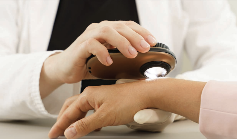 physician hand holding patient hand and examining skin with a tool