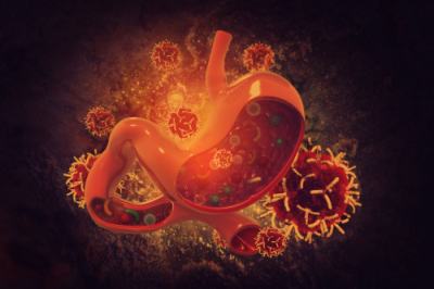 Diagram of stomach surrounded by cancer cells | Rutgers Cancer Institute of New Jersey