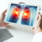 photo of hands in a white coat holding a tablet with an illustration of lungs with tumors